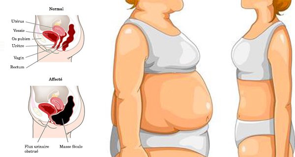 Comment perdre la graisse pubienne ? –
